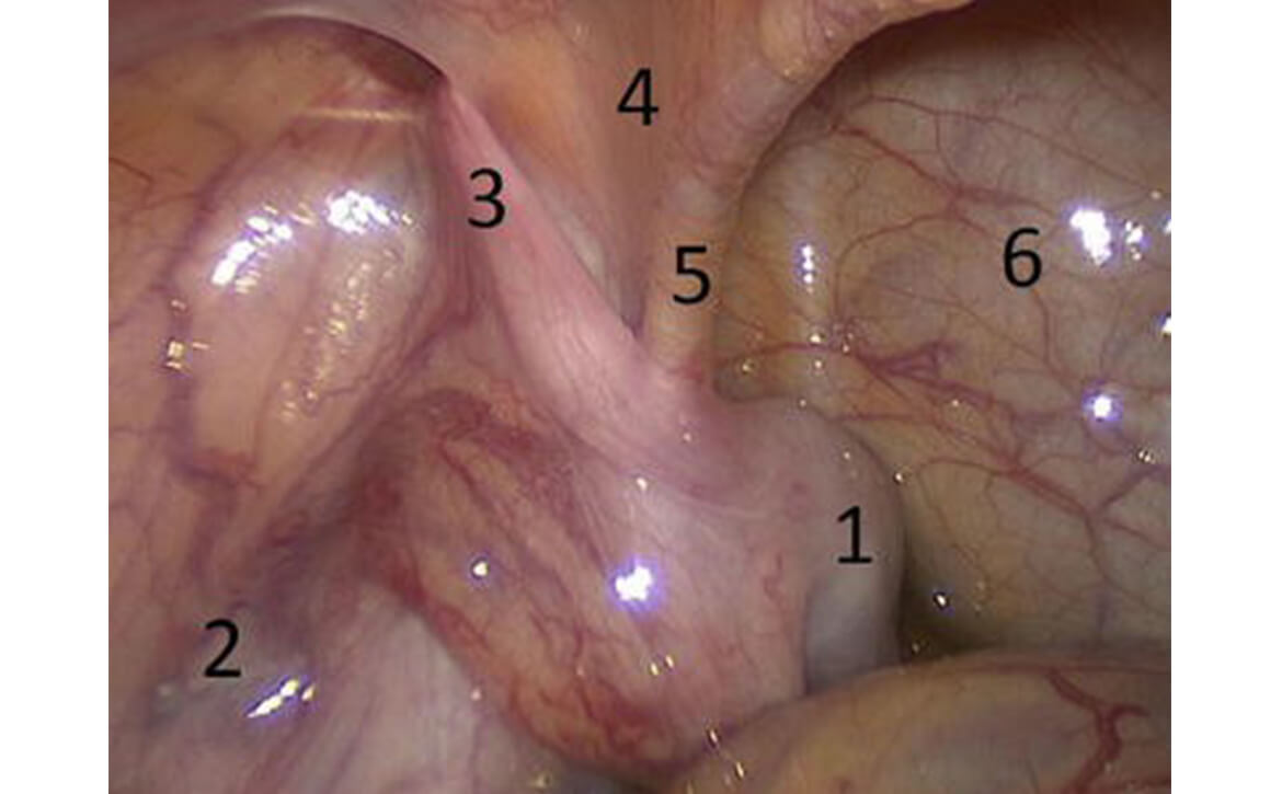Meilleur urologue pédiatrique en Inde, urologie pédiatrique robotique